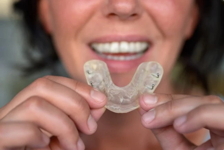 до и после исправления прикуса реальные истории